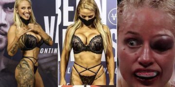 Boxeadora invicta que llegó al pesaje en ropa interior pierde la pelea, termina con un ojo destrozado y sin título mundial